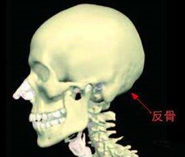 脑后有反骨