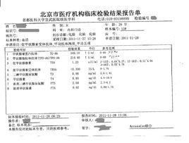 甲状腺球蛋白抗体