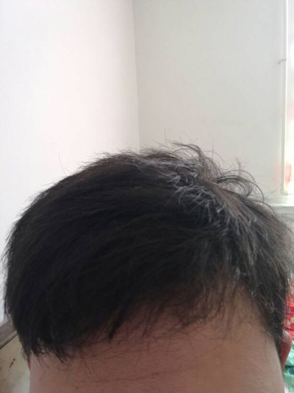 我男生头发干燥粗糙有细有软洗头还爱掉发用七岁丸子扎孩子头图片