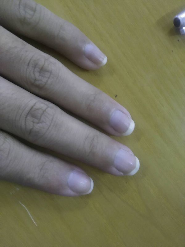 我长出来的手指甲是白色的,不透明,和别人的不