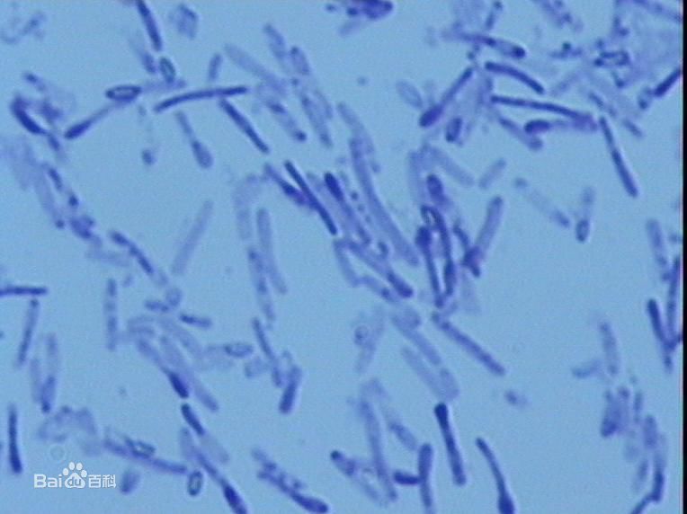 初倍里含有几种菌株,有没有嗜热链球菌啊?