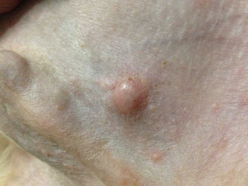 快三个月大的金毛肚皮那长了很多疙瘩,其中一