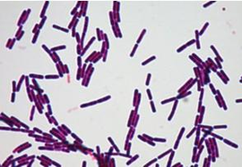 炭疽杆菌分布图片